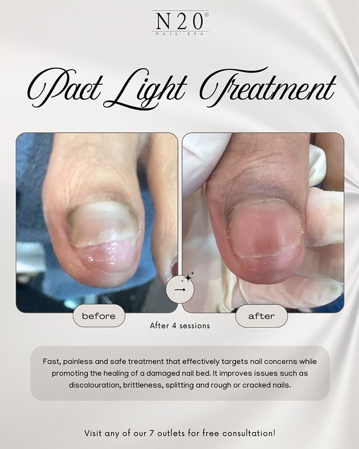 Toenail & fingernail renewal treatment