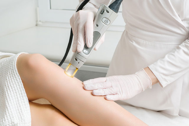 OPT Hair Removal